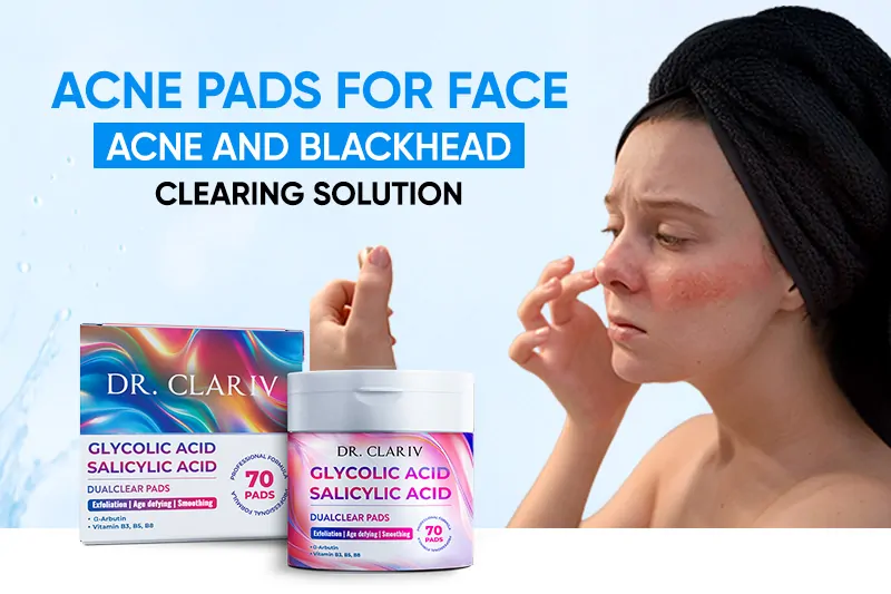 acne-pads-for-face-effective-solutions-to-clear-acne-and-blackheads