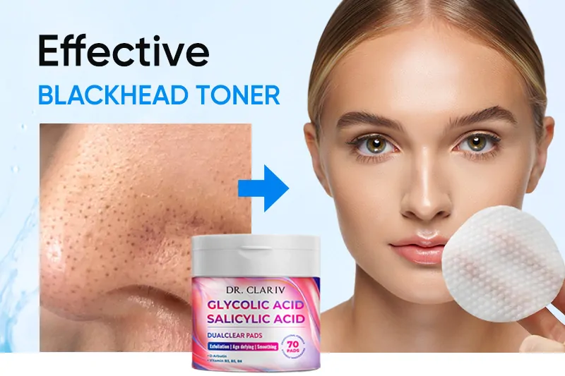 effective-blackhead-toner-how-to-eliminate-blackheads-and-cleanse-your-skin-properly
