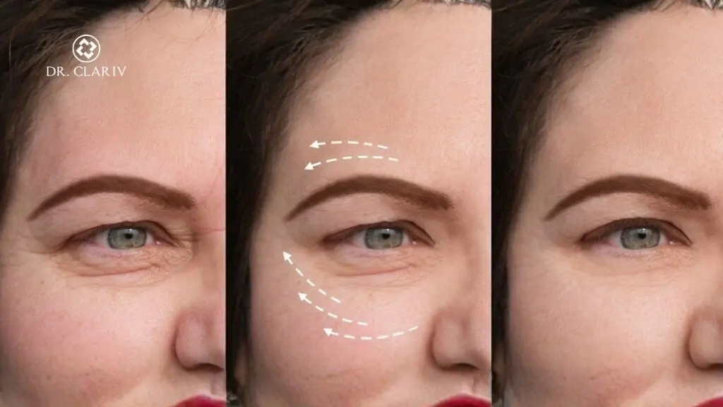 caffeine smooths under eye lines